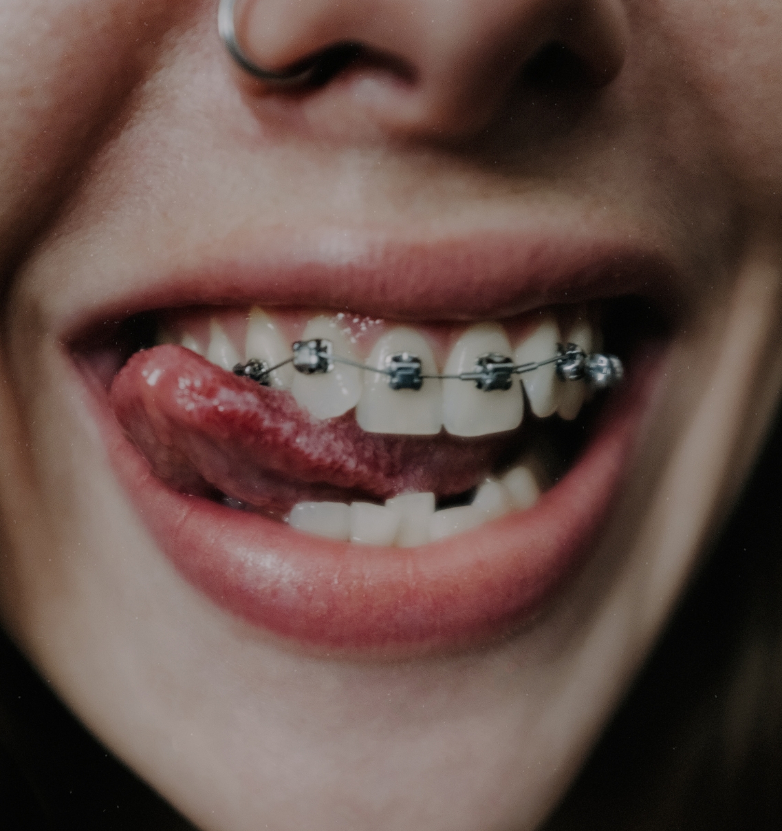 brackets