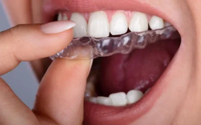 Ortodoncia invisible: la opción estética y cómoda para alinear tu sonrisa